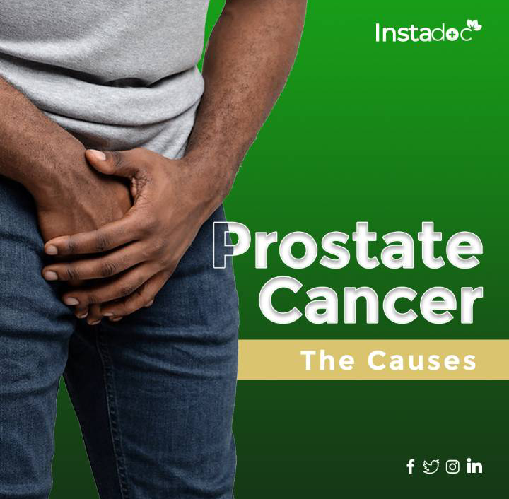 PROSTATE CANCER -THE CAUSES